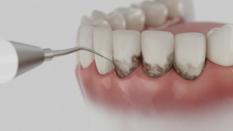 Reliable Dental contractor in Coldwater, OH by Dentist Open Now
